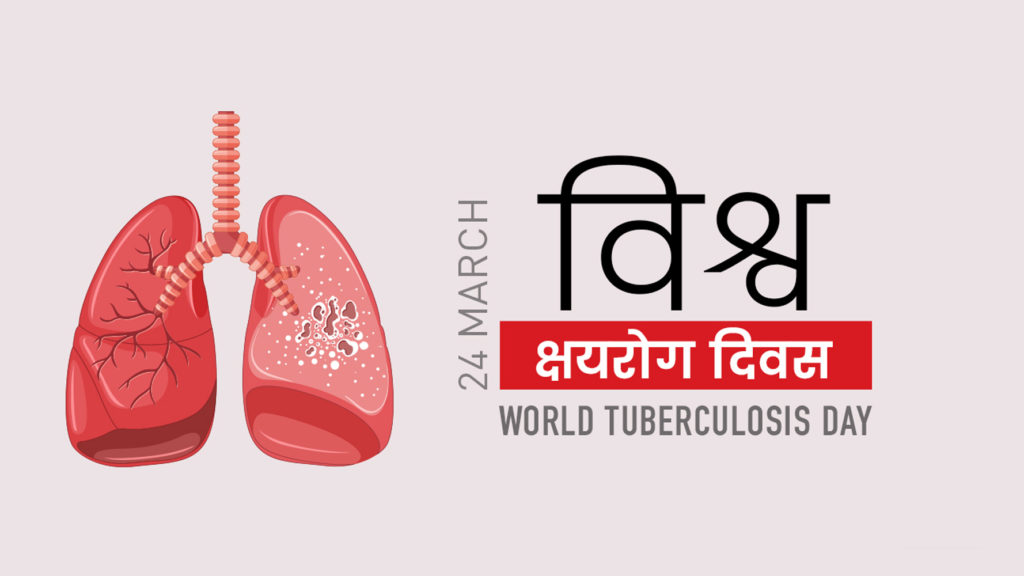 विश्व क्षयरोग दिवस : लागूपदार्थको दुर्व्यसनले क्षयरोग विश्वकै दोस्रो घातक संक्रामक रोग