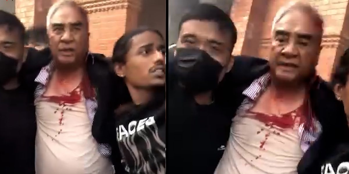 आन्दोलनकारीको आक्रमणमा घरभित्रै रहेका देउवा दम्पत्ती घाइते